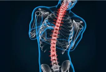 Scolisis Spine surgeon in chennai